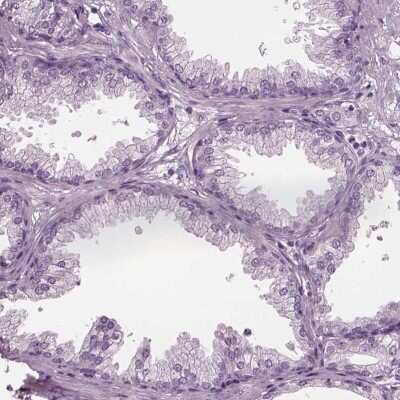 Immunohistochemistry-Paraffin: TPPP2 Antibody [NBP1-88430]