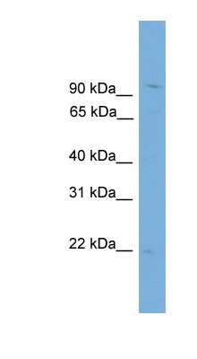 Western Blot: TPPP3 Antibody [NBP1-57639]