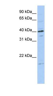 Western Blot: TPPP3 Antibody [NBP1-57640]