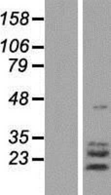 Western Blot: TPPP3 Overexpression Lysate [NBP2-07104]