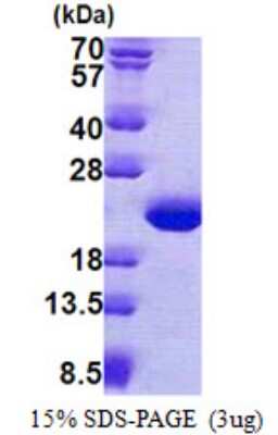 SDS-PAGE: Recombinant Human TPPP3 His Protein [NBP2-22900]