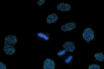 Immunocytochemistry/ Immunofluorescence: TPR Antibody [NB100-2866]