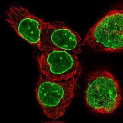 Immunocytochemistry/ Immunofluorescence: TPR Antibody [NBP1-89448]