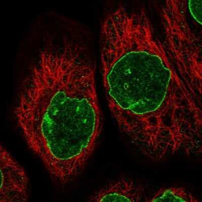 Immunocytochemistry/ Immunofluorescence: TPR Antibody [NBP1-89451]