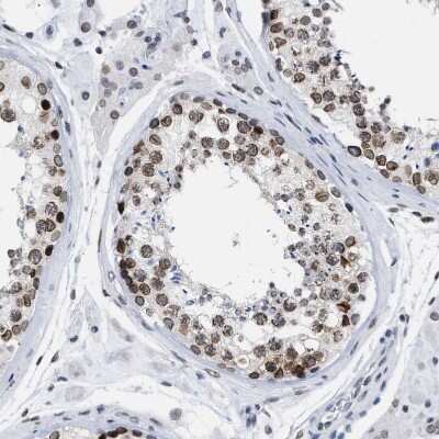 Immunohistochemistry-Paraffin: TPR Antibody [NBP1-89451]
