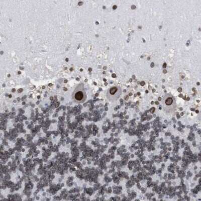 Immunohistochemistry-Paraffin: TPR Antibody [NBP1-89451]