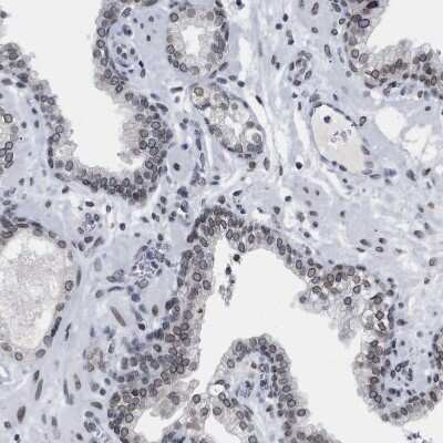 Immunohistochemistry-Paraffin: TPR Antibody [NBP1-89451]