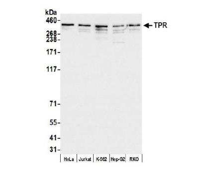 Western Blot: TPR Antibody [NB100-2865]