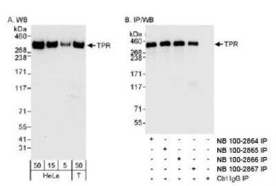 Western Blot: TPR Antibody [NB100-2866]