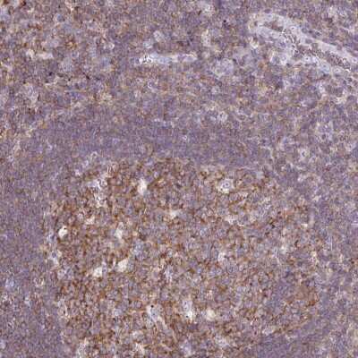 Immunohistochemistry-Paraffin: TPRG1 Antibody [NBP2-49311]