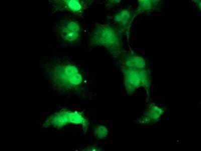 Immunocytochemistry/ Immunofluorescence: TPRKB Antibody (OTI3H3) [NBP2-03885]