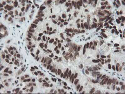 Immunohistochemistry-Paraffin: TPRKB Antibody (OTI3H3) [NBP2-03885]