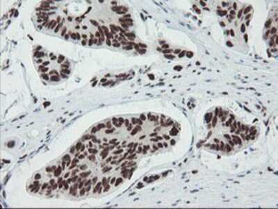 Immunohistochemistry-Paraffin: TPRKB Antibody (OTI3H3) [NBP2-03885]