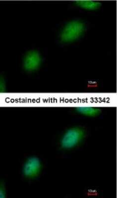 Immunocytochemistry/ Immunofluorescence: TPRKB Antibody [NBP1-31618]