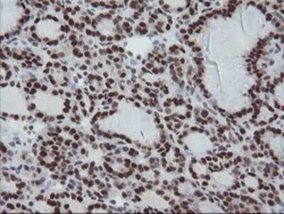 Immunohistochemistry: TPRKB Antibody (OTI3H3) - Azide and BSA Free [NBP2-74574]