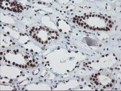 Immunohistochemistry: TPRKB Antibody (OTI3H3) - Azide and BSA Free [NBP2-74574]