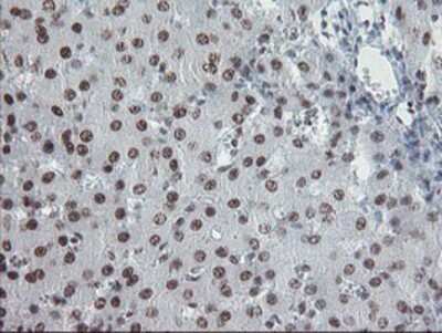 Immunohistochemistry: TPRKB Antibody (OTI3H3) - Azide and BSA Free [NBP2-74574]