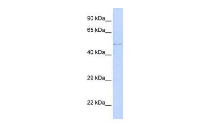 Western Blot: TPRX1 Antibody [NBP2-85974]