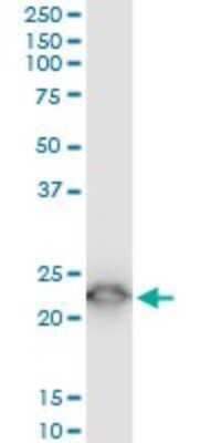 Western Blot: TPT1/TCTP Antibody (2C4) [H00007178-M03]