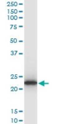 Western Blot: TPT1/TCTP Antibody (2C4) [H00007178-M03]