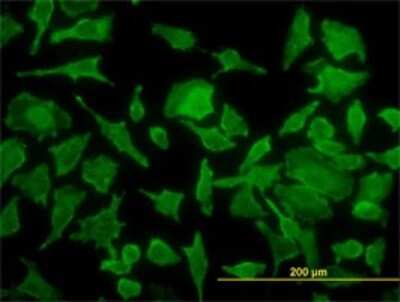 Immunocytochemistry/ Immunofluorescence: TPT1/TCTP Antibody (3C7) [H00007178-M01]