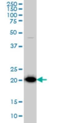 Western Blot: TPT1/TCTP Antibody (3C7) [H00007178-M01]