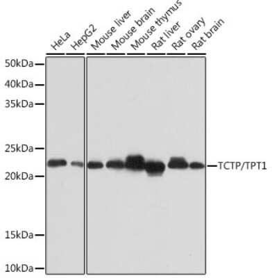 Western Blot: TPT1/TCTP Antibody (9H7S4) [NBP3-16122]