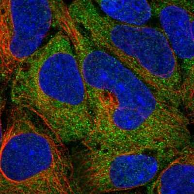 Immunocytochemistry/ Immunofluorescence: TPT1/TCTP Antibody [NBP2-38447]