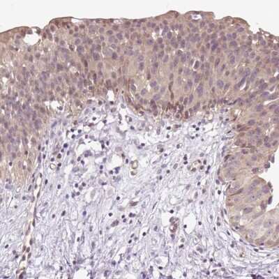 Immunohistochemistry-Paraffin: TPT1/TCTP Antibody [NBP2-38447]