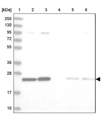 Western Blot: TPT1/TCTP Antibody [NBP2-38447]