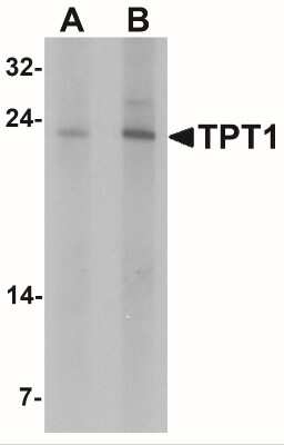 Western Blot: TPT1/TCTP AntibodyBSA Free [NBP2-41206]