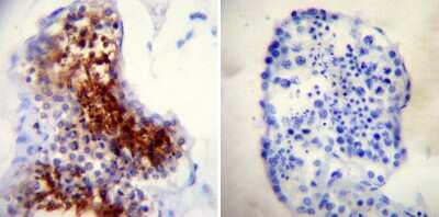 Immunohistochemistry-Paraffin: TPX2 Antibody (18D5-1) [NB100-74556]