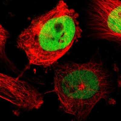 Immunocytochemistry/ Immunofluorescence: TPX2 Antibody [NBP1-88312]