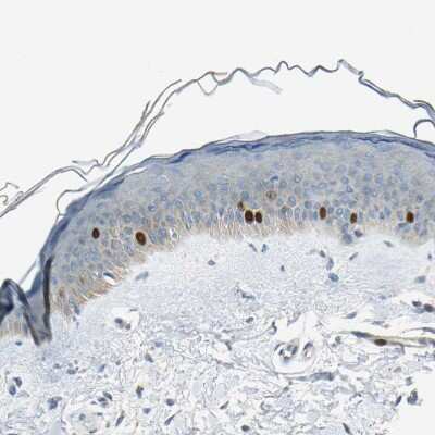 Immunohistochemistry-Paraffin: TPX2 Antibody [NBP1-88312]