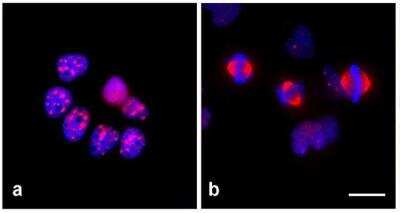 Immunocytochemistry: TPX2 Antibody (TPX2-01) - BSA Free [NBP2-67265]