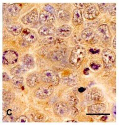 Immunohistochemistry: TPX2 Antibody (TPX2-01) - BSA Free [NBP2-67265]