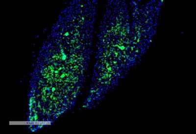 Immunohistochemistry: TR alpha/NR1A1/Thyroid Hormone Receptor alpha Antibody (H43) [NBP2-79822]