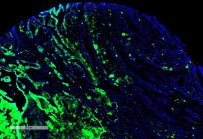 Immunohistochemistry: TR alpha/NR1A1/Thyroid Hormone Receptor alpha Antibody (H43) [NBP2-79822]