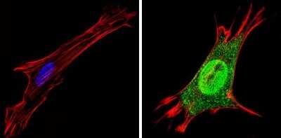 Immunocytochemistry/ Immunofluorescence: TR alpha/NR1A1/Thyroid Hormone Receptor alpha Antibody [NBP2-22523]