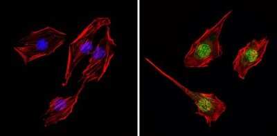 Immunocytochemistry/ Immunofluorescence: TR alpha/NR1A1/Thyroid Hormone Receptor alpha Antibody [NBP2-22523]