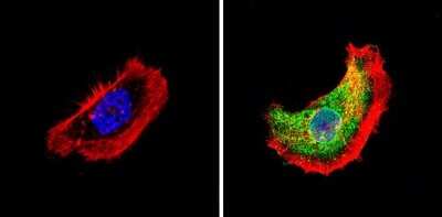 Immunocytochemistry/ Immunofluorescence: TR alpha/NR1A1/Thyroid Hormone Receptor alpha Antibody [NBP2-22523]