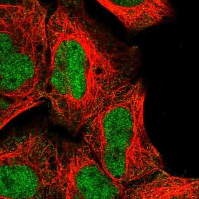 Immunocytochemistry/ Immunofluorescence: TR2/NR2C1 Antibody [NBP2-55133]