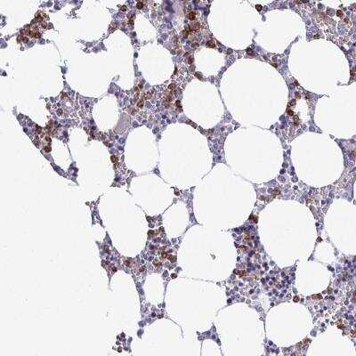 Immunohistochemistry-Paraffin: TR2IT1 Antibody [NBP2-31707]