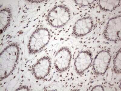 Immunohistochemistry: TR4/NR2C2 Antibody (OTI4B1) [NBP2-46228]