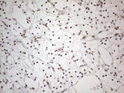 Immunohistochemistry: TR4/NR2C2 Antibody (OTI4B1) [NBP2-46228]