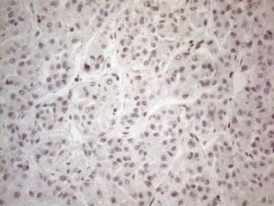 Immunohistochemistry: TR4/NR2C2 Antibody (OTI4B1) [NBP2-46228]