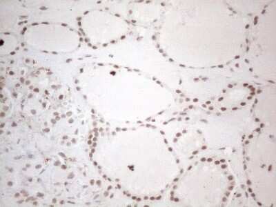 Immunohistochemistry: TR4/NR2C2 Antibody (OTI4B1) [NBP2-46228]