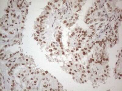 Immunohistochemistry: TR4/NR2C2 Antibody (OTI4B1) [NBP2-46228]