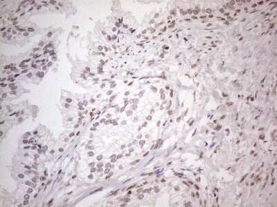 Immunohistochemistry: TR4/NR2C2 Antibody (OTI4B1) [NBP2-46228]