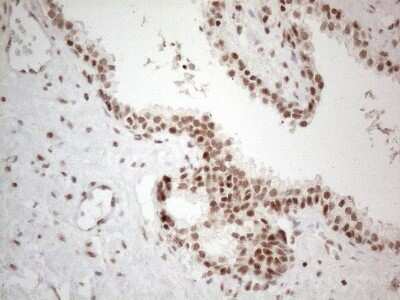 Immunohistochemistry: TR4/NR2C2 Antibody (OTI4B1) [NBP2-46228]